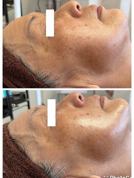 private salon Ponola【ポノーラ】/カーボキシー