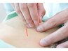 -新規-【鍼灸×整体】カウンセリング込み　お試しコース　3,980円