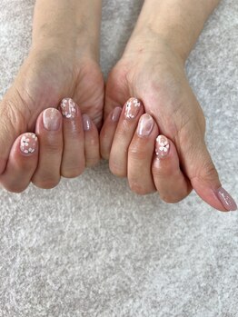 ラモネイル(RamoNAIL)/