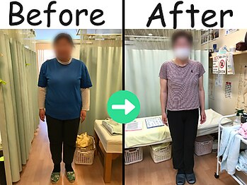 杉本接骨鍼灸院/【ダイエット】46歳　28.5キロ！