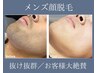 【メンズ顔脱毛】抜け抜群/第一印象で差をつける/清潔感アップ