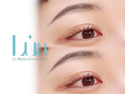 ルア(LUA by Wyne BeautyClinic)の写真