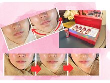 オスマンティエ(Osmantier)/レモンボトル進化レッドショット