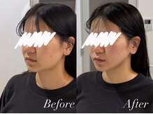 ハクト(Hakuto)/Before/After