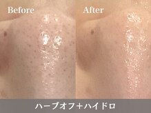 トウメイコガオ 横浜店/トウメイコガオでハーブ