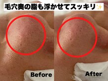 チル スキンスタジオ(CHILL skin studio)の雰囲気（豊中口コミ１位の毛穴洗浄！長年の毛穴の悩みもお任せください♪）
