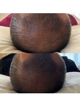 リラクゼーションの森/