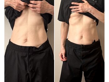 ベラ/初回でこの結果！【腸もみ】