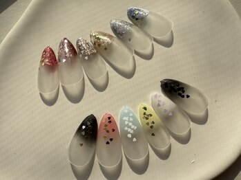 アイリー(IRY)の写真/フット&ハンド同時施術も可◎スピーディーな施術で忙しい人や隙間時間にもオススメ《フィルイン専門店》