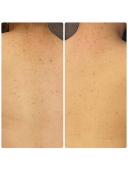 エクラ(eclat)/クリスティーナ