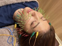 樹鍼灸整骨院/美容鍼