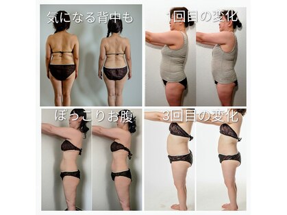 ヨサパーク アカーシャ(YOSA PARK AKASHA)の写真