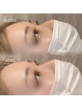 フラワー(FLOWER)/＆Healthy