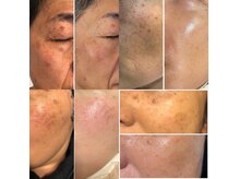 la veriteの雰囲気（結果重視！本気のシミ改善【エイジングケア】）