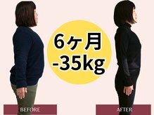 ジュピテールの雰囲気（人気No1【結果重視】耳つぼ＋栄養士の食事指導で徹底サポート☆）