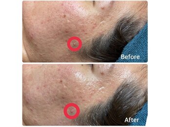 ちらちゅら/クリスティーナ【アンストレス】