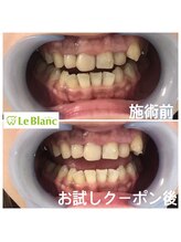 ルブラン 奈良店(Le Blanc)/着色汚れ気になりませんか？