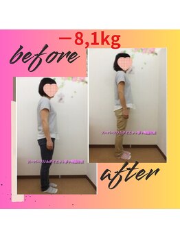 スーパースリムダイエット茅ヶ崎 茅ヶ崎整体院/3ヵ月－8,1ｋｇ減ダイエット♪