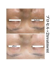 ヒルナム(Heal Nam)/プロセルセラピーズ~フェイス~