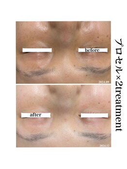 ヒルナム(Heal Nam)/プロセルセラピーズ~フェイス~