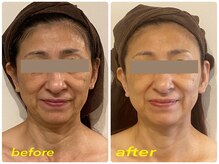 イオム ビューティワーク(IOM BEAUTY WORK)