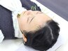 【人気☆】頭痛/疲れ目/首すじ肩こり/不眠　鍼60分＋美容鍼30本♪100分¥9,000