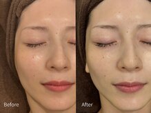 アウラ 小杉店(AULA)/ララピール☆