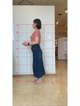 カエデ鍼灸整骨院 セントシティ店(KAEDE鍼灸整骨院)/反り腰