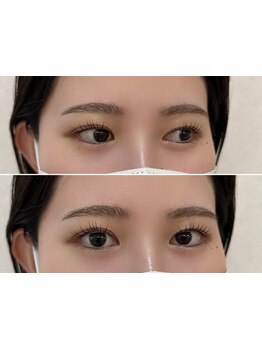 まつげのお悩み解決サロン