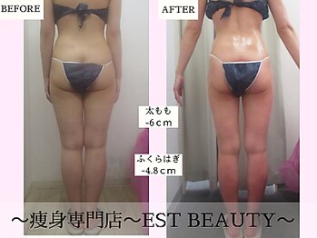 エストビューティー 池袋店(EST BEAUTY)/結果の出る技術【池袋/痩身】