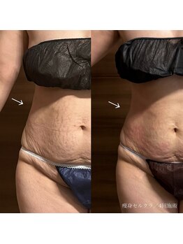 エクラ(eclat)/セルクラ