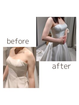 サニー(SUNNY)/二の腕もほっそり♪