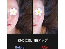 美容矯正サロン レレポノ(LELEPONO)/