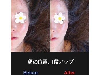 美容矯正サロン レレポノ(LELEPONO)/