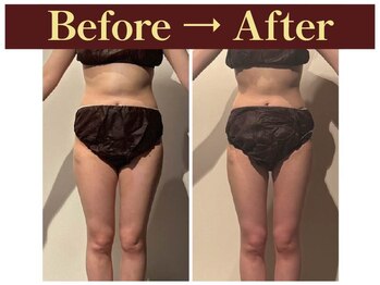 グレースフルタイム プレミアム(Graceful Time PREMIUM)/ビフォーアフター