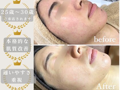 ピュア(pure)の写真