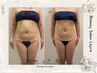 『★満足度No.1全身贅沢フルコース★』本気痩せ&強力デトックス 120分◎