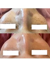 アンク(Ankh)/どの角度から見られても怖くない