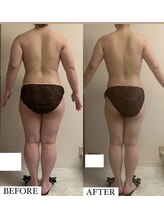 フェミニー(Feminy)/全身痩身術！