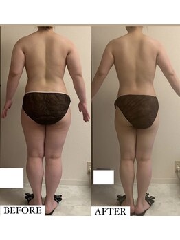 フェミニー(Feminy)/全身痩身術！