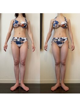 レナトゥス 銀座(Renatus)/BeforeAfter【痩身/東京/銀座】