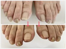 爪処 中野坂上/フットケア