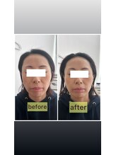 リリースパ 辻堂店(Lily spa)/効果抜群？！