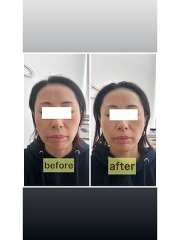 リリースパ 辻堂店(Lily spa)/効果抜群？！