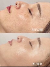 ティアラ 錦糸町(TIARA)/