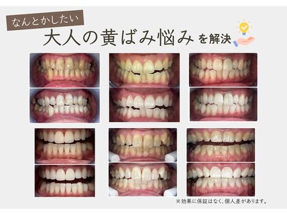 ブライト 八王子(bright)の写真