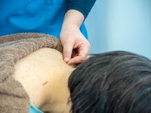 かがやき鍼灸整骨院