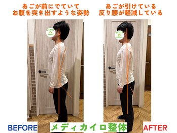 四条大宮アシスト鍼灸整骨院/全身整体ビフォーアフター