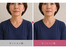 ライフ ピラティス スタジオ(LIFE Pilates Studio)/首がスッキリ見えると印象が変化