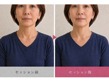 ライフ ピラティス スタジオ(LIFE Pilates Studio)/首がスッキリ見えると印象が変化